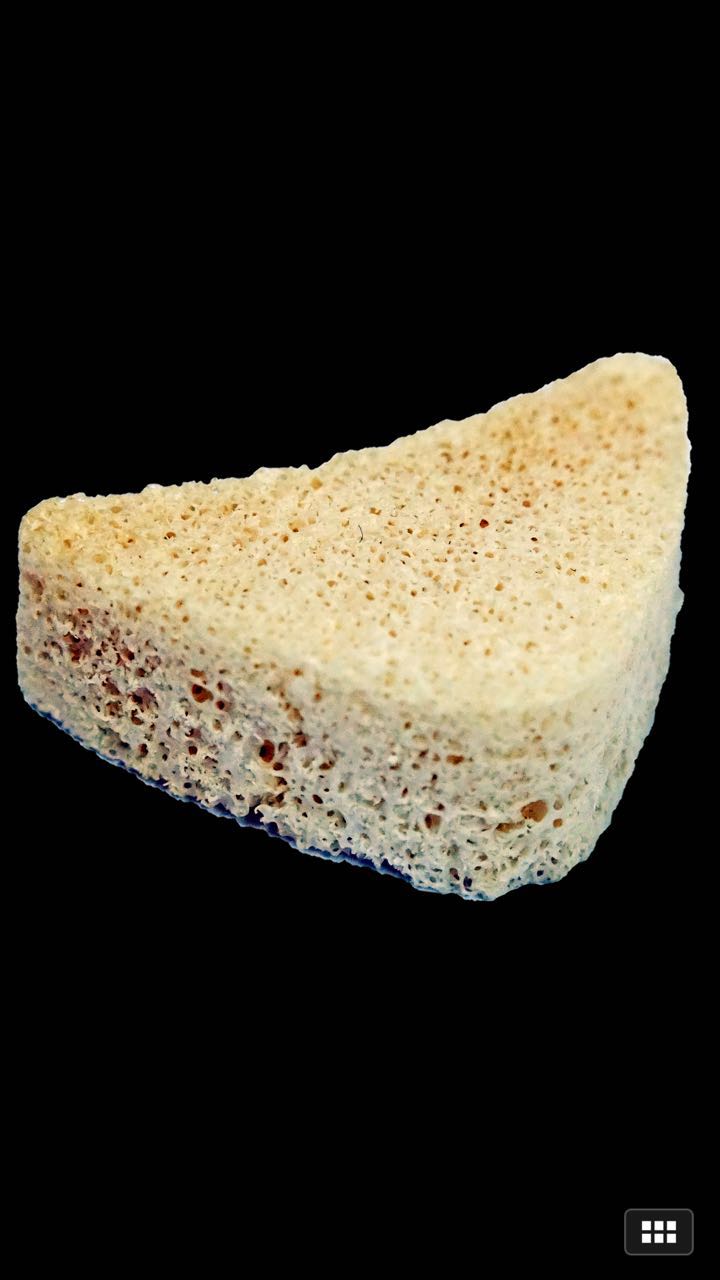 3d手术导板 楔形同种异体骨 3.5/5.0梅花双牙锁定螺钉