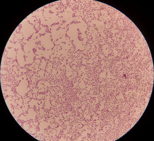 大肠杆菌,金黄色葡萄球菌,绿脓杆菌,霉菌,白杰尔袍子菌等细菌菌群.