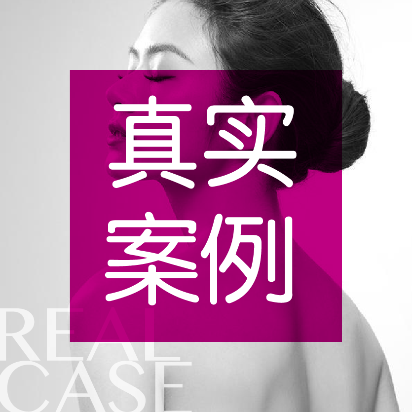 Yon'Age高科美颜真实案例